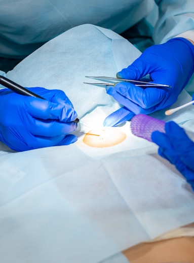 The surgeon does surgery to remove the mole on the patient's back. The process of burning moles in a private clinic to remove moles iStock 1161255474